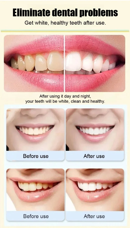 SP-4 Probiotic Intensive Whitening Toothpaste